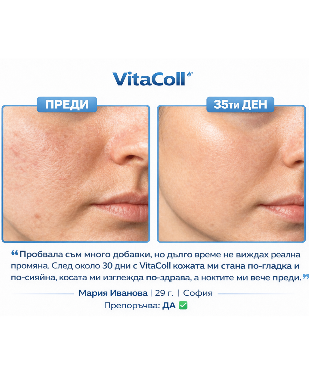 Натурален морски колаген на прах VitaColl™